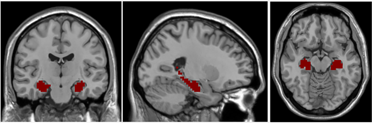 Hippocampus